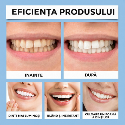 Solutie albire dinti